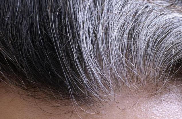 神草传奇非遗养发馆：2024年为什么白发人群越来越多了