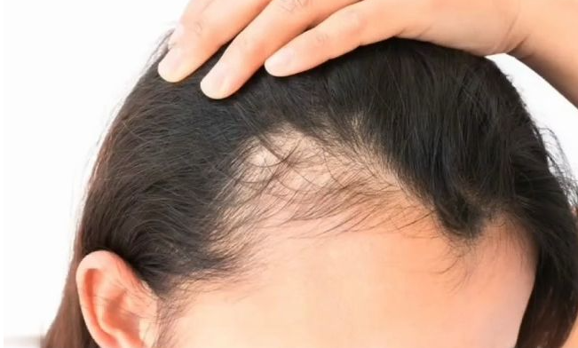 神草传奇养发馆告诉你白头发最怕的食物都有哪些